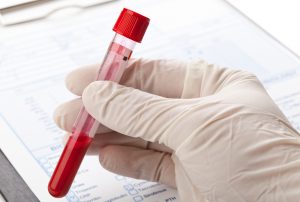 Blood test