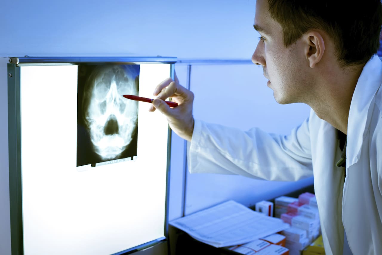 A specialist diagnosing head and neck cancer using x-ray imaging