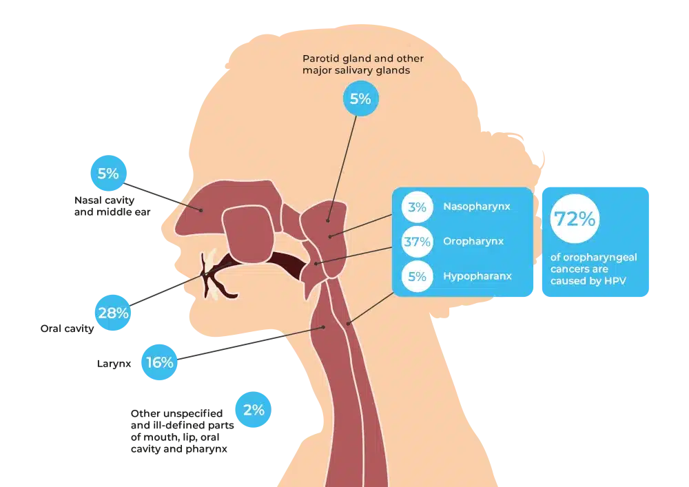 Head and neck cancer statistics (Leeds trust)