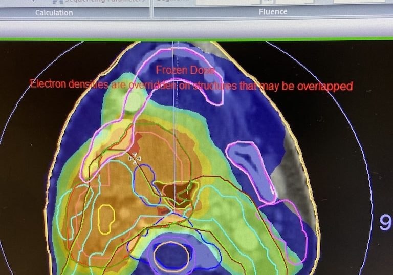 Diagnostic scan for head and neck cancer